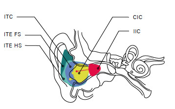 Audífonos ubicados en el interior del oído
