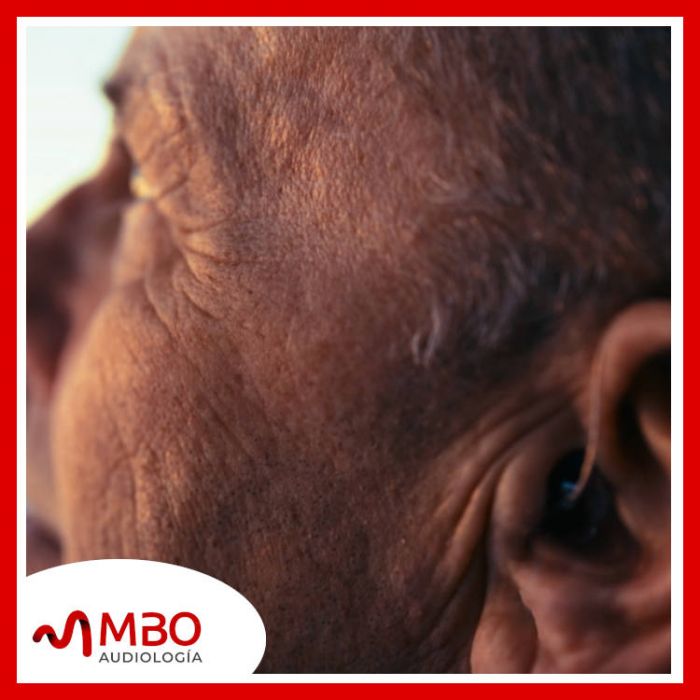 El Día Internacional del Implante Coclear en MBO Audiología